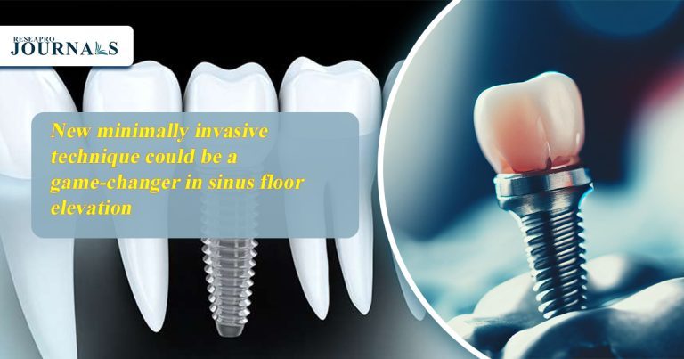 New minimally invasive technique could be a game-changer in sinus floor ...